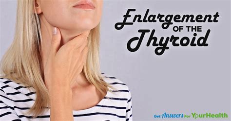 Enlargement Of Thyroid Health Solutions Plus