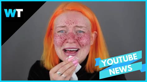 Video Permanent Freckle Beauty Fail Goes Viral