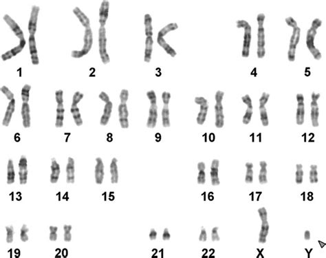 23 Chromosomes Paires De Chromosomes Writflx