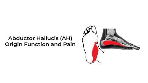 Abductor Hallucis Ah Originfunction And Pain ~ Statcardiologist