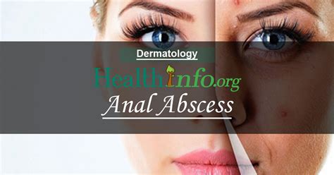 Anal Abscess Health