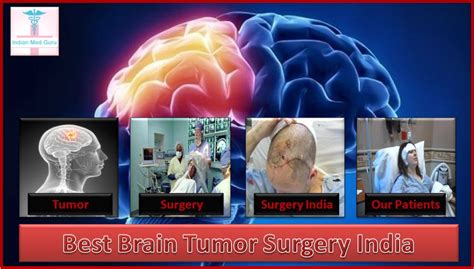 Who Needs Brain Tumor Surgery Indianmedguru