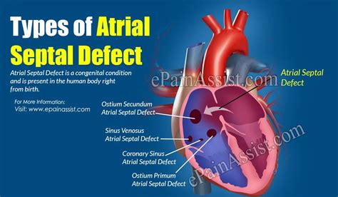 Atrial Septal Defect Symptoms In Infants