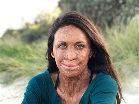 Turia Pitt How To Rewrite Your Own Story Uncover The University Of Canberra