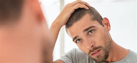 What Really Causes Hair Loss In Men And What To Do About It Hum