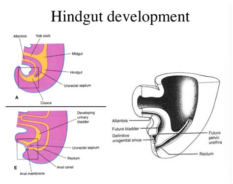 Development Of Midgut And Hindgut Mistryland