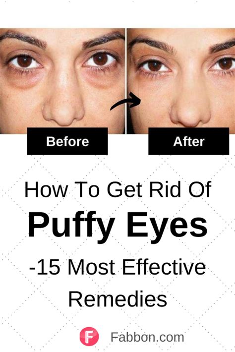 15 Most Effective Home Remedies For Puffy Eyes In 2021 Puffy Eyes Remedy Puffy Eyes Puffy