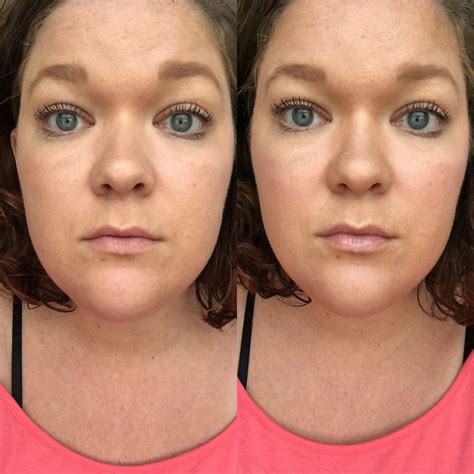 Hottie Lip Plumper 15 Minutes Between Pictures Before And After