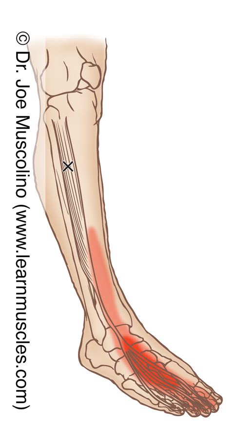 Extensor Digitorum Longus Trigger Points Learn Muscles