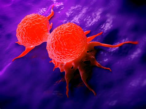 Just A Small Number Of Cells In A Tumor Can Enable Cancer To Spread To