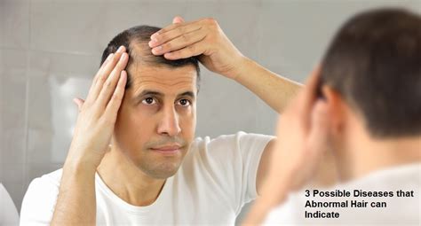 3 Possible Diseases That Abnormal Hair Can Indicate Lifefitnesstricks