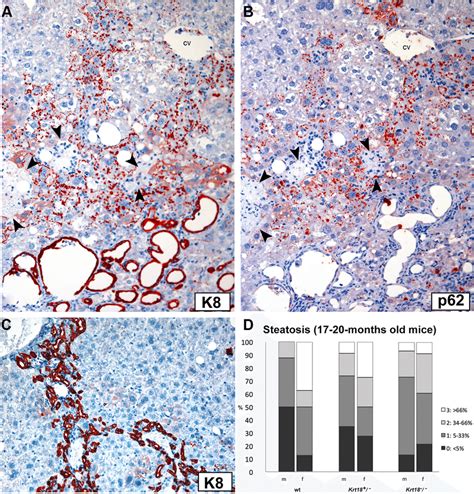 Immunohistochemistry Of A Parenchymal Area In The Liver Of An Old Krt18
