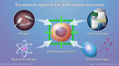 Diagnosing And Treating Soft Tissue Sarcoma