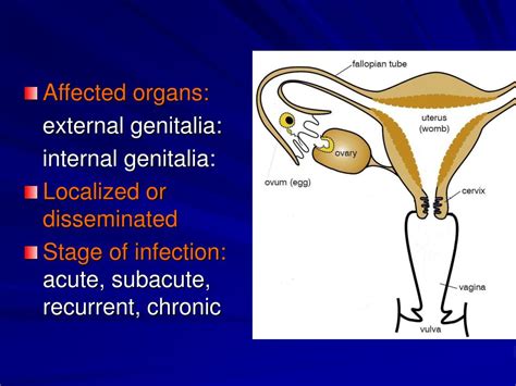 Ppt Infection Of Female Reproductive System Powerpoint Presentation