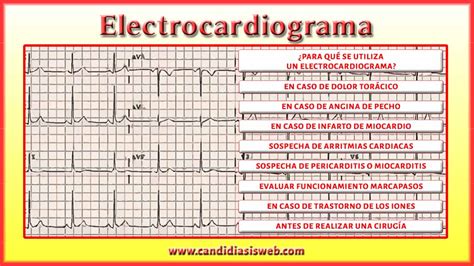 1 Aprendiendo A Leer Un Electrocardiograma ¿cómo Funciona El Corazón