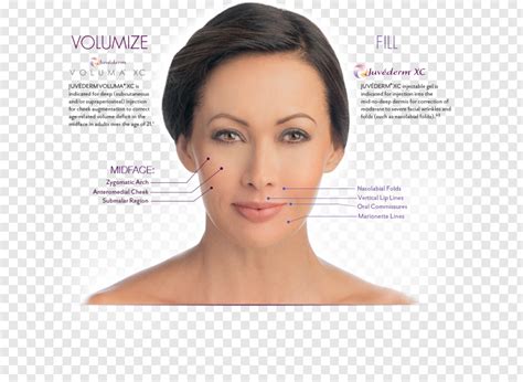 Bruise How Png Bruise Juvederm Transparent Png 1244x910 21720661