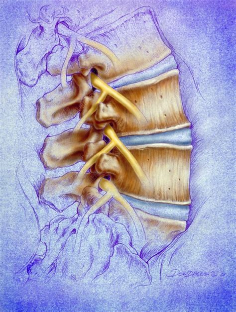 Lumbar Spine Stock Image P1160471 Science Photo Library