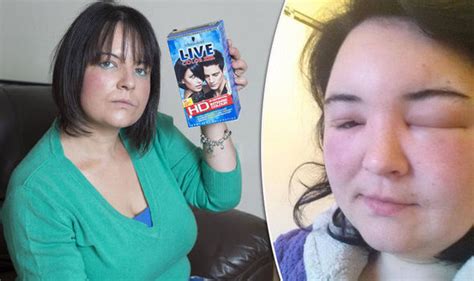 These chemicals are usually derived from petroleum or coal tar derivatives, which contain benzene, toluene, xylene and other carcinogenic substances. Mum temporarily BLINDED after severe allergic reaction to ...