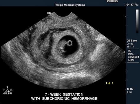 Fetal Ultrasound Image Gallery Imaging Technology News