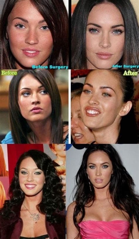 Madison beer for vevo lift campaign, december 2020. Megan Fox Before And After Surgery | Hollywood clásico ...