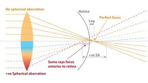 Spherical Aberration Accommodation And Multifocal Soft Contact Lenses