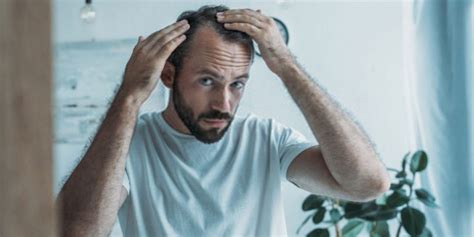 Best Hair Loss Treatment Options For Men