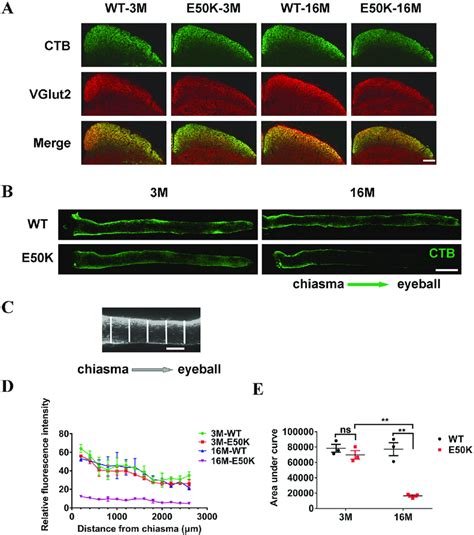 Tracing The Retrograde Axonal Transport In Wt And Optn E50k Mice