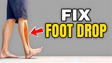 3 Exercises To Correct Foot Drop Youtube