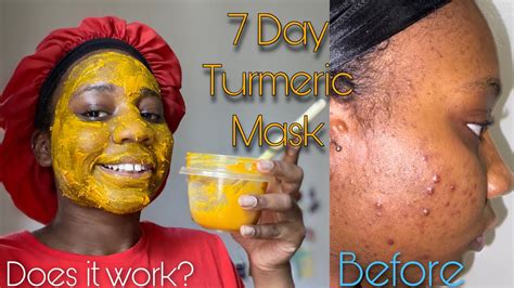 Diy Honey Face Mask For Dark Spots Homemade Face Mask To Remove Dark Spots Scars And Stains In