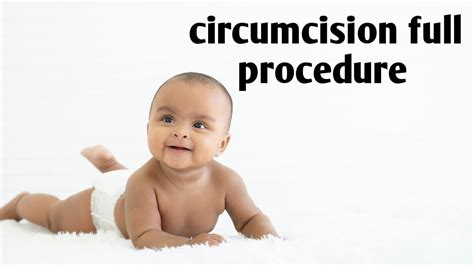 how to do classical circumcision circumcision procedure circumcised dorsal slit circumcision zsr