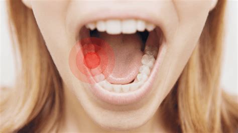 6 Major Causes Of Toothache Their Solution And Prevention Nedufy