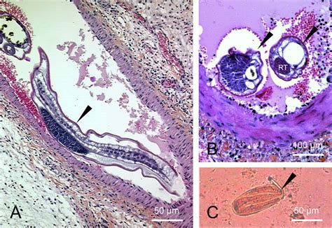Microscopical Aspects Of The Ileal Specimen And Parasitic Stools