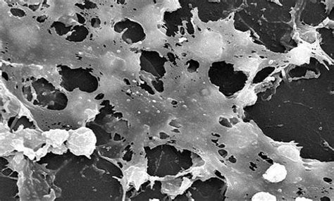 Batterio aerobo del genere stafilococco, gram positivo e di forma sferica, saprofita o talvolta parassita dell uomo, sul quale produce pigmenti gialli o arancioni. Stafilococco aureo: sintomi e infezioni - Idee Green