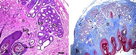 Photomicrograph Showing A Epidermis E And Dermis D Consisted Of