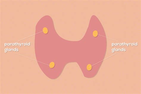 Symptoms Of Hyperparathyroidism Thyroid Clinic Sydney
