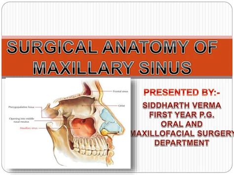 Maxillary Sinus Presentation Ppt
