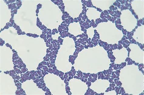 S Epidermidis Under Microscope Micropedia