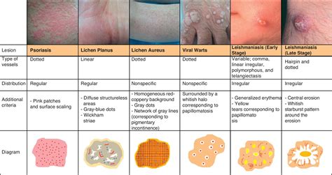 Beautiful Types Of Skin Lesions Chart Green House Schools