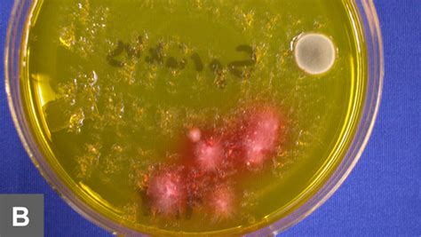 Microscopic Examination Of Fungal Cultures Clinicians Brief