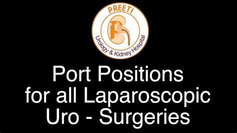 Port Positions For All Laparoscopic Uro Surgeries Youtube