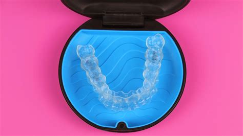 Tips To Help You Maintain Your Invisalign Clear Aligners
