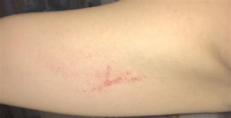 Weird Red Spots On Skin Askdocs