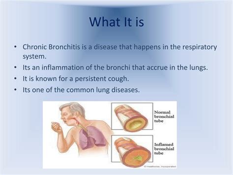 Ppt Respiratory System Chronic Bronchitis Powerpoint Presentation
