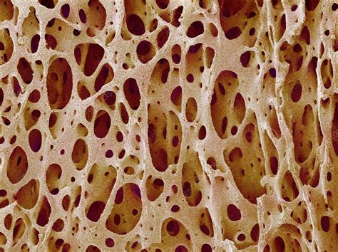 That is, how its smallest parts are assembled into larger structures. The Human Body: Bone Tissue- Research.