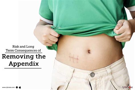 Risk And Long Term Consequences Of Removing The Appendix By Dr S P