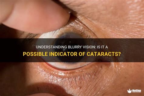 Understanding Blurry Vision Is It A Possible Indicator Of Cataracts