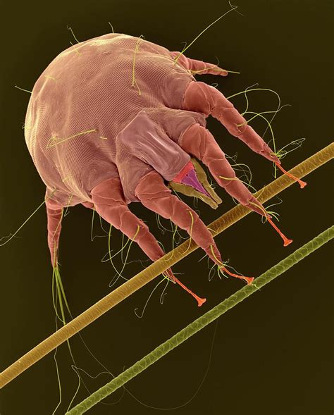 Rabbit Ear Mite Psoroptes Cuniculi Photograph By Dennis Kunkel