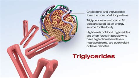 High Triglycerides Causes Symptoms High Triglycerides Diet And Treatment