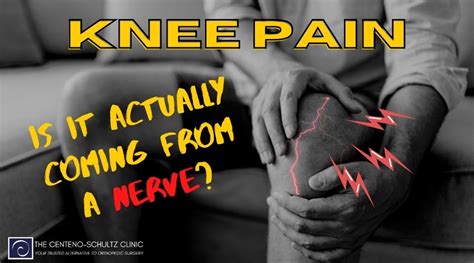 Nerve Pain In Knee Causes Symptoms And Treatments