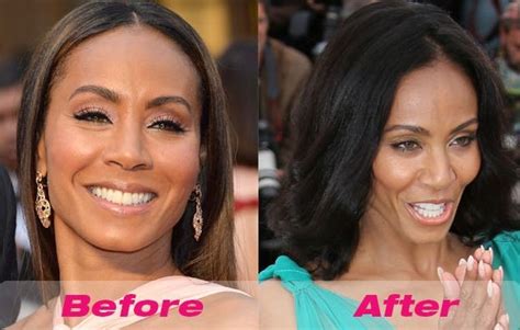 Jada Pinkett Smith Before And After Plastic Surgery 07 Celebrity